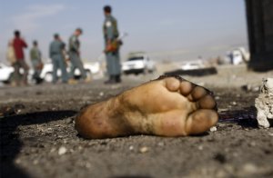 Нога террориста-смертника взорвавшего себя, из-за взрыва погибло три мирных жителя и один был ранен. 22 июля 2008 год. REUTERS/Ahmad Masood